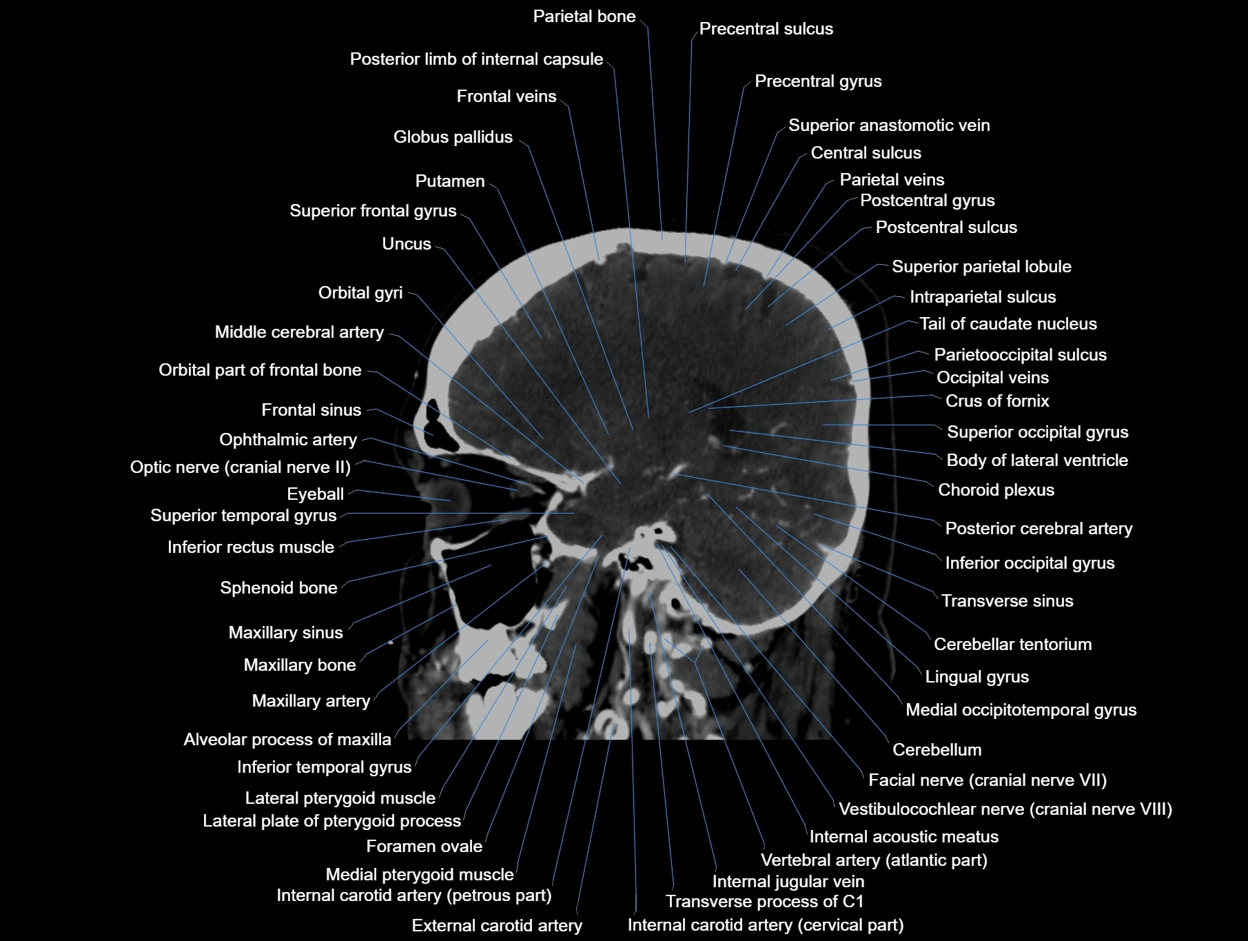 CT scan brain sagittal cross sectional anatomy image-img-00001-00028.webp